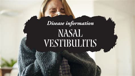 Nasal vestibulitis covid. Things To Know About Nasal vestibulitis covid. 